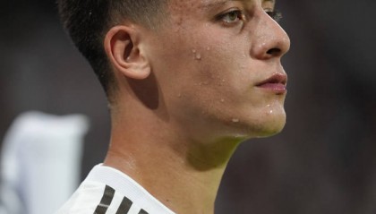 姆巴佩倒下震惊足坛:皇马核心伤情成谜,世界杯预选赛或受影响