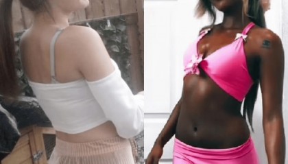 英国18岁少女日光浴成瘾,几乎每天晒,有皮肤癌风险仍停不下来