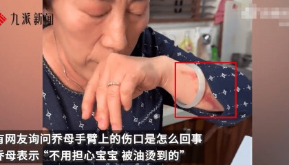 乔任梁母亲回应手臂伤口:被油烫到的