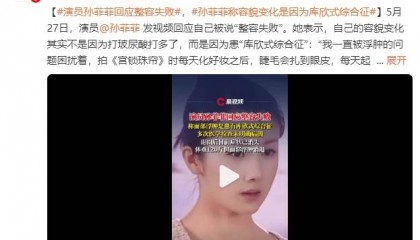 演员孙菲菲回应整容失败!称容貌变化是因为患“库欣式综合征”
