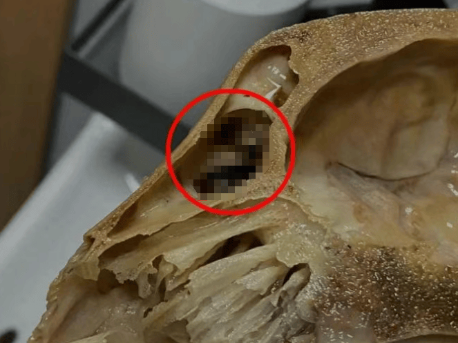 吃完发现全是蛆,恶心呕吐一整夜!上海法院判了:赔1000元