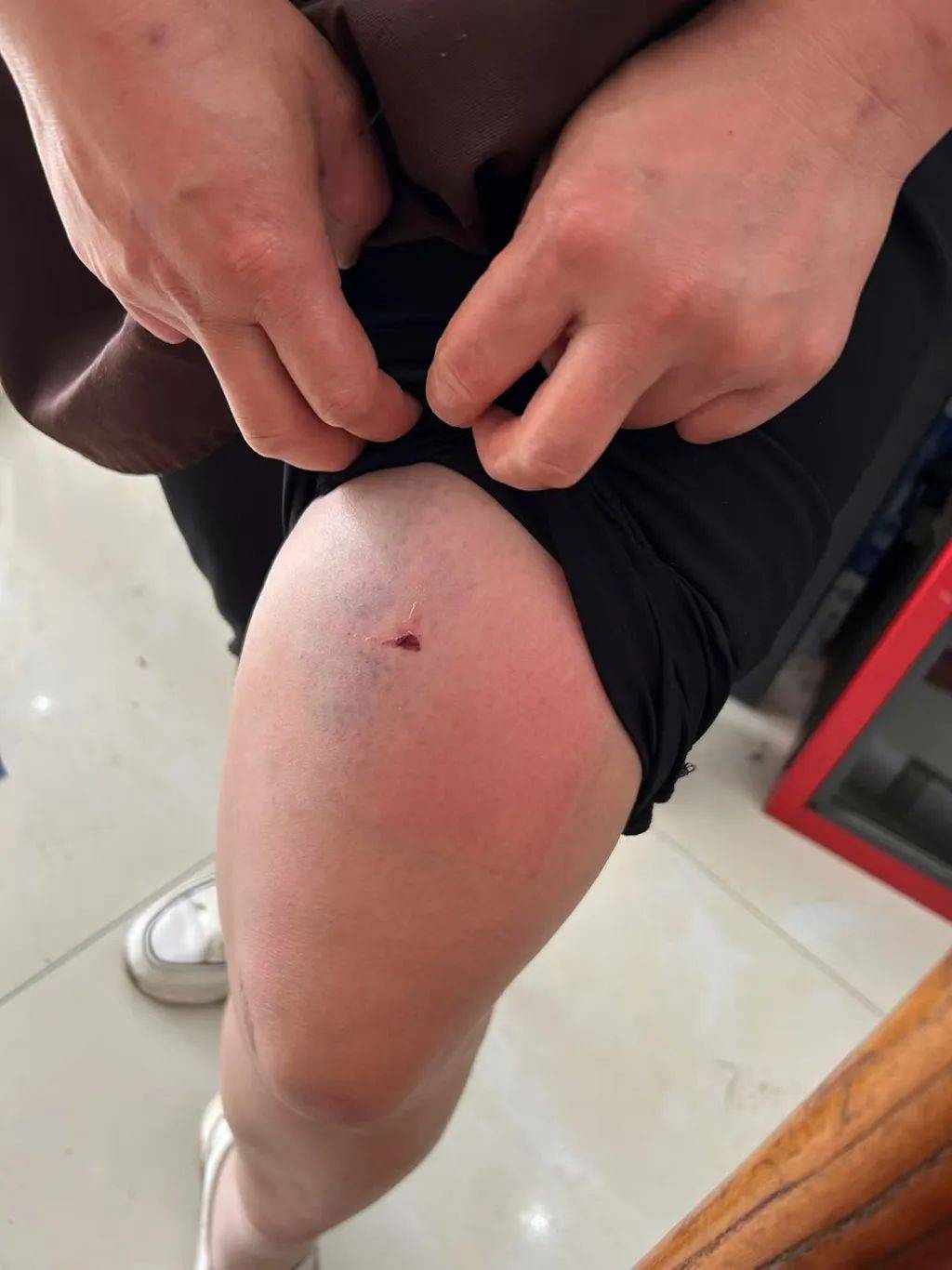 云南一男子酒后逼问妻子“是否出轨”并施暴，被警方行拘4日