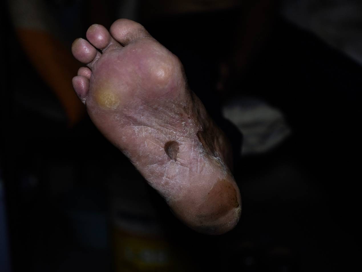 他们挤在8元一晚的旅店 几百人抢一个活